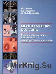 Мочекаменная болезнь. Актуальные вопросы диагностики и выбора метода лечения