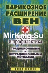 Варикозное расширение вен. Лечение и профилактика традиционными и нетрадиционными методами