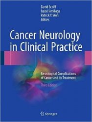Cancer Neurology in Clinical Practice: Neurological Complications of Cancer and its Treatment, 3rd Edition