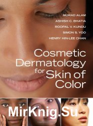 Cosmetic dermatology for skin of color